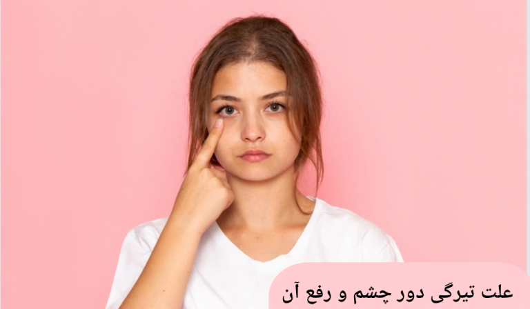 علت تیرگی دور چشم و رفع آن